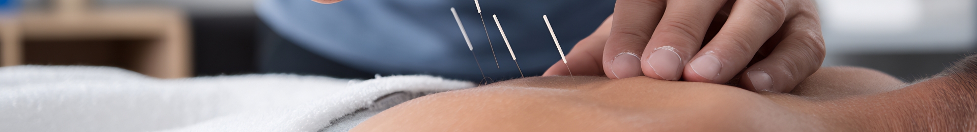 Dry Needling
